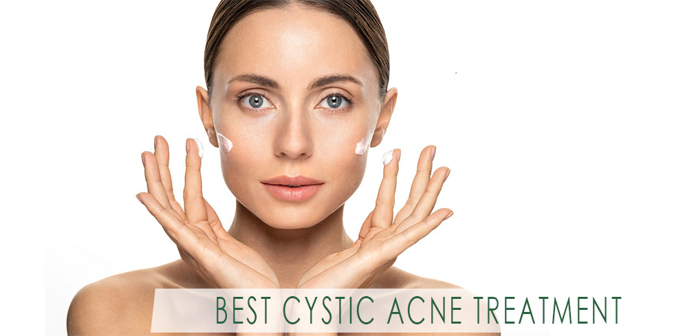 Best cyctic acne creams