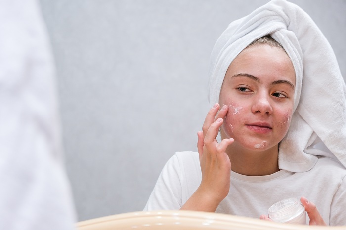 Teenage girl apllying cream to treat acne