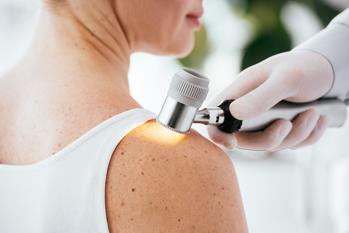 patient shoulder being checked by a dermatologist